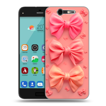 Силиконовый чехол на ZTE Blade S7 с принтом Розовые бантики Силиконовый чехол на ZTE Blade S7 с принтом Розовые бантики