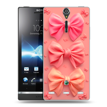 Пластиковый чехол на Sony Xperia S с принтом Розовые бантики Пластиковый чехол на Sony Xperia S с принтом Розовые бантики