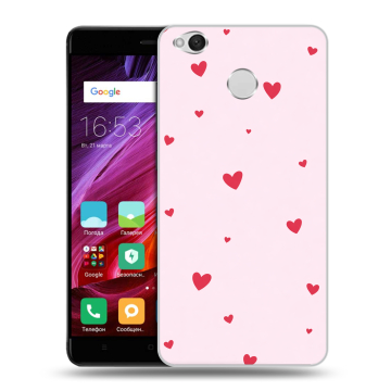 Силиконовый противоударный чехол на Xiaomi RedMi 4X с принтом для девочек Силиконовый противоударный чехол на Xiaomi RedMi 4X с принтом для девочек