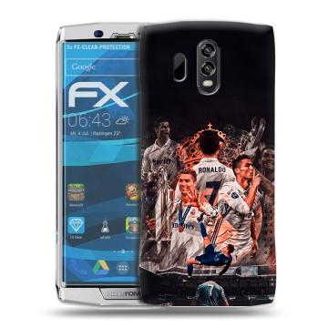 Силиконовый чехол на Homtom HT70 с принтом Реал Роналдо Real Ronaldo Силиконовый чехол на Homtom HT70 с принтом Реал Роналдо Real Ronaldo