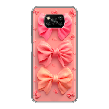 Пластиковый чехол на Xiaomi Poco X3 с принтом Розовые бантики Пластиковый чехол на Xiaomi Poco X3 с принтом Розовые бантики