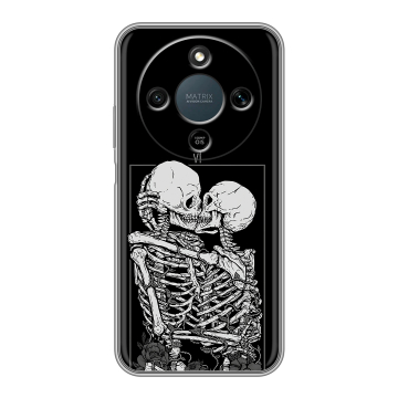 Силиконовый чехол на Honor X9d с принтом Поцелуй скелетов Силиконовый чехол на Honor X9d с принтом Поцелуй скелетов